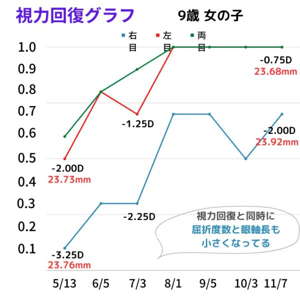 視力回復グラフ9才女子